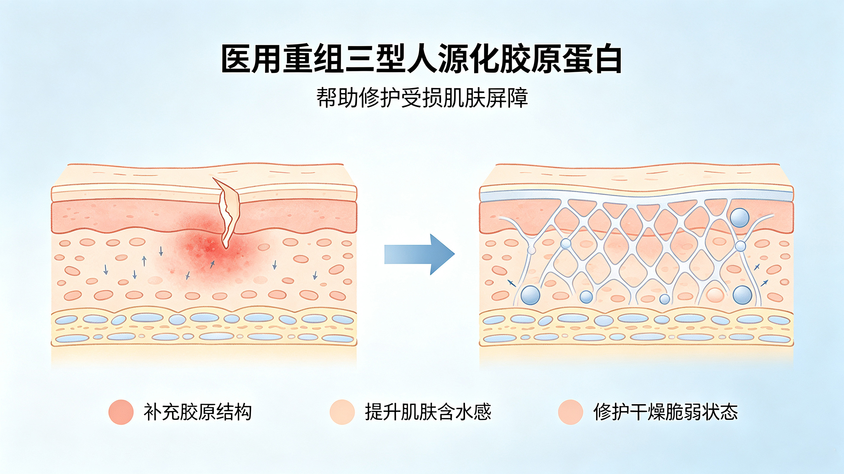 医用重组三型人源化胶原蛋白科普 (2) 医用重组三型人源化胶原蛋白科普 (2)